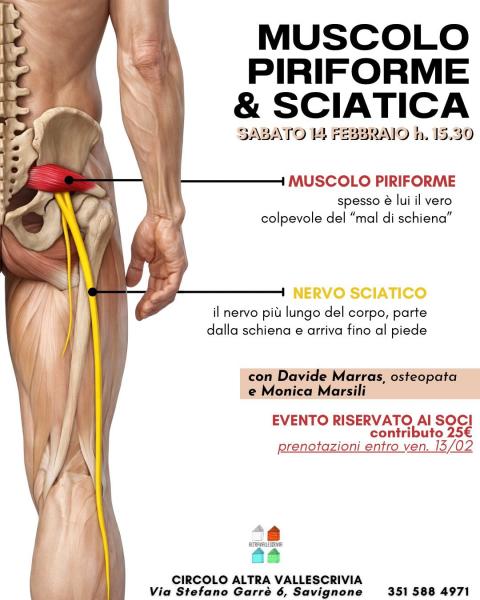 Muscolo Piriforme e sciatica